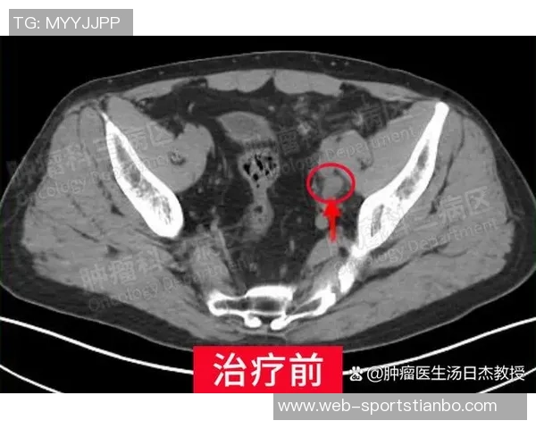 埃奇库姆小腿恢复良好场均144分展现出色状态 埃奇库姆小腿恢复良好场均144分展现出色状态